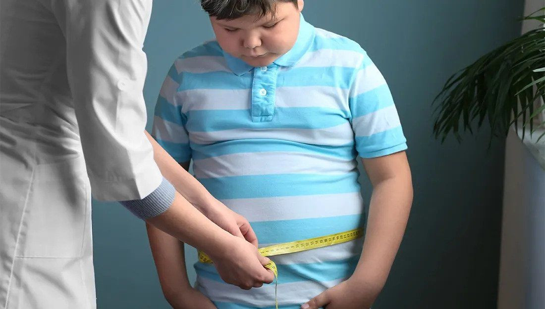 obesitas pada anak